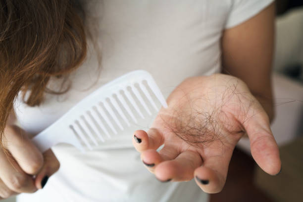 Excellent Opportunities for Hair Loss Treatment in Women