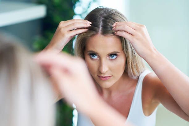 hair loss treatment for women 